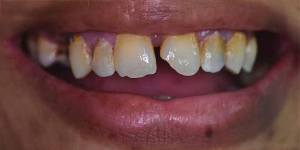 Before Image