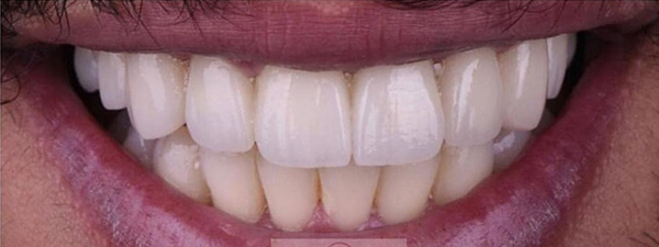 After Image