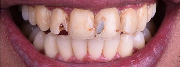 Before Image