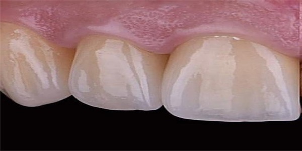 After Image