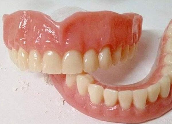 Acrylic Full/Partial Denture