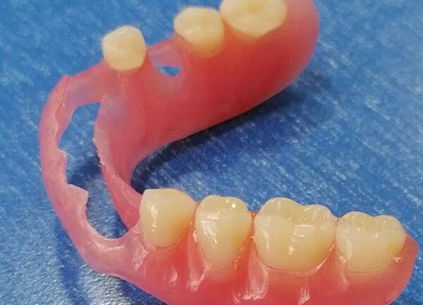 Flexible Full/Partial Denture