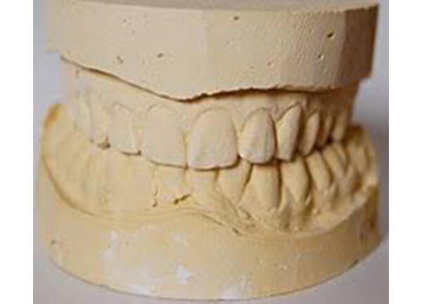 Study Model Stone