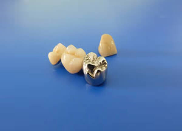 PFM/Non Precious Crown