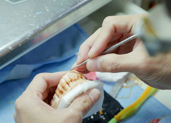 Wax Up Smile Design
