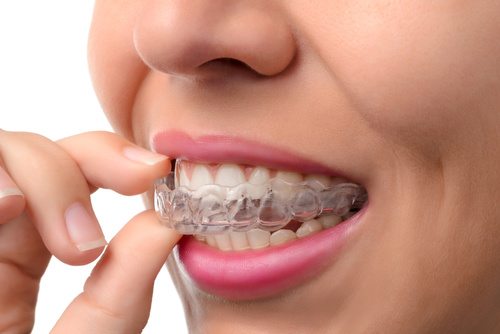 Sheet Retainer