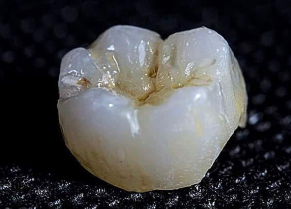 Crown